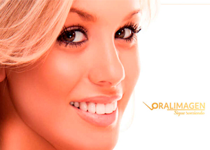 Imagen de Carillas Dentales