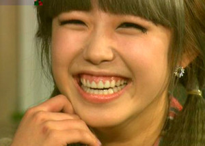 Imagen de Sonrisa Gingival