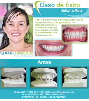 Imagen de Caso de Éxito - Ortodoncia 