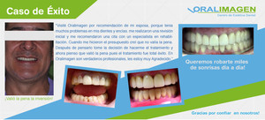 Imagen de Caso de éxito - Desgastes Severos