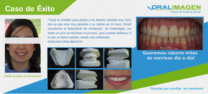 Imagen de Caso de Éxito - Ortodoncia 